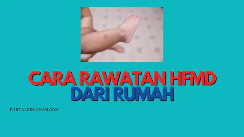 img/posts/CARA-RAWATAN-HFMD-DARI-RUMAH.webp